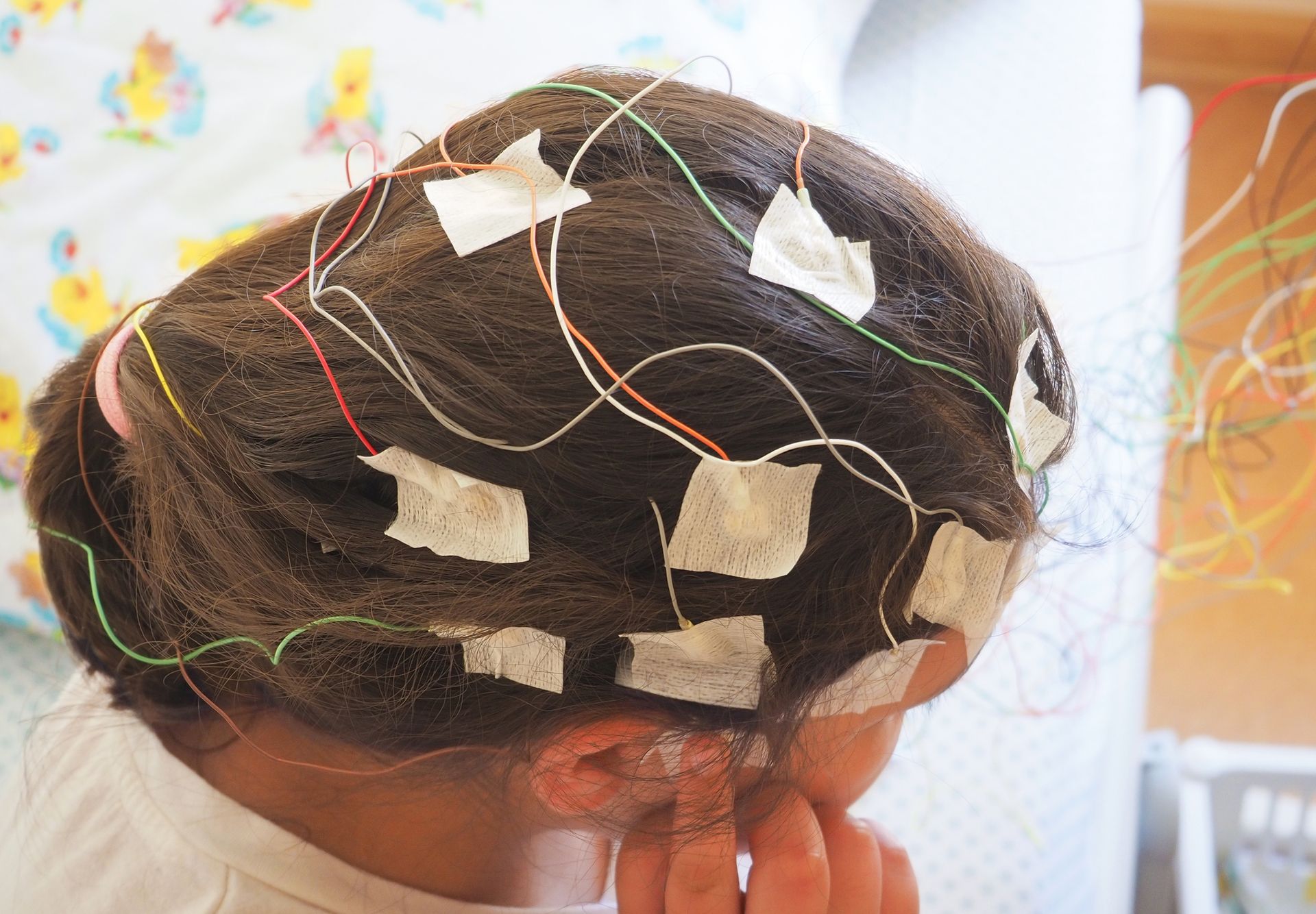 Elettroencefalografia: Registrazione dell'Attività Cerebrale